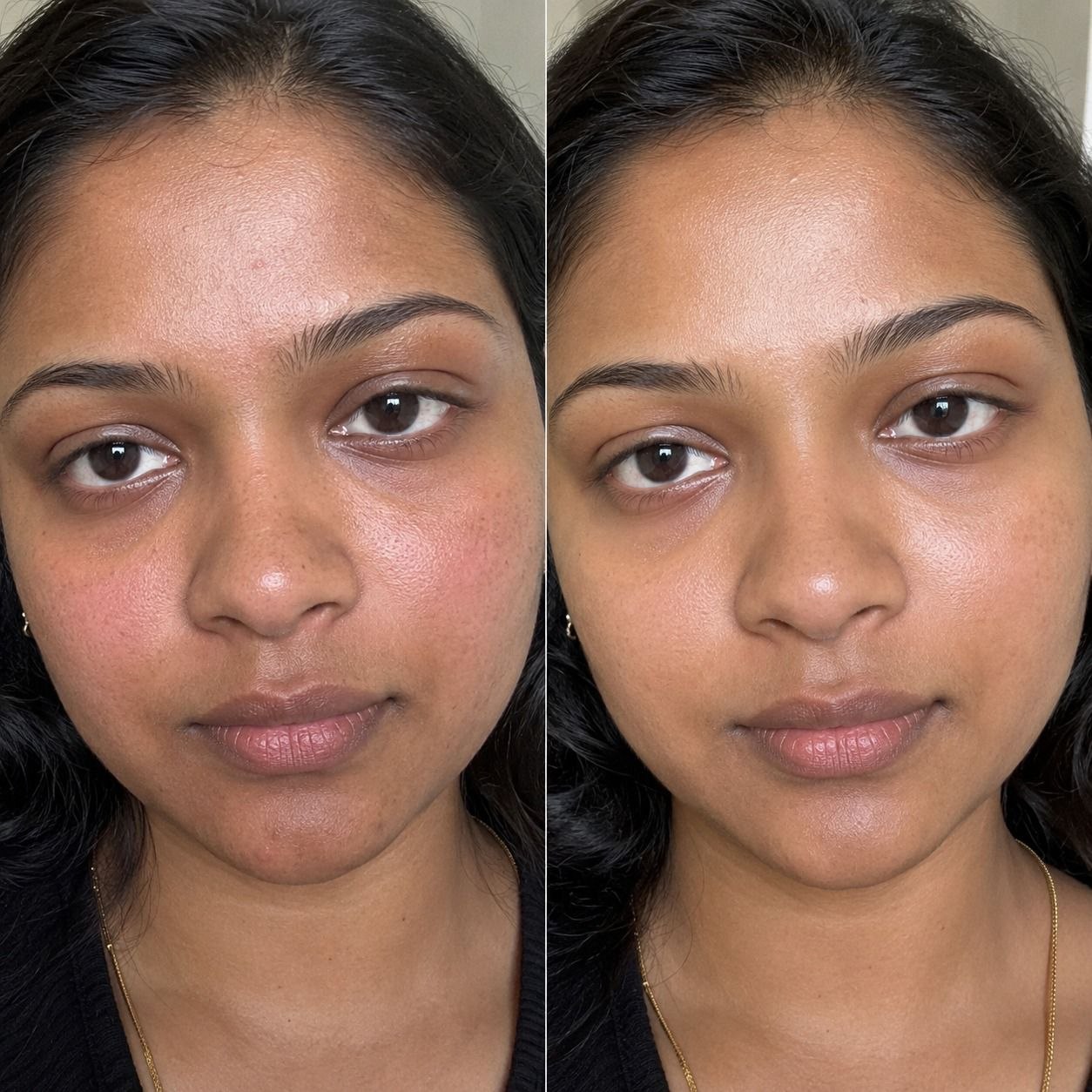 Skin before using Grace Face Serum